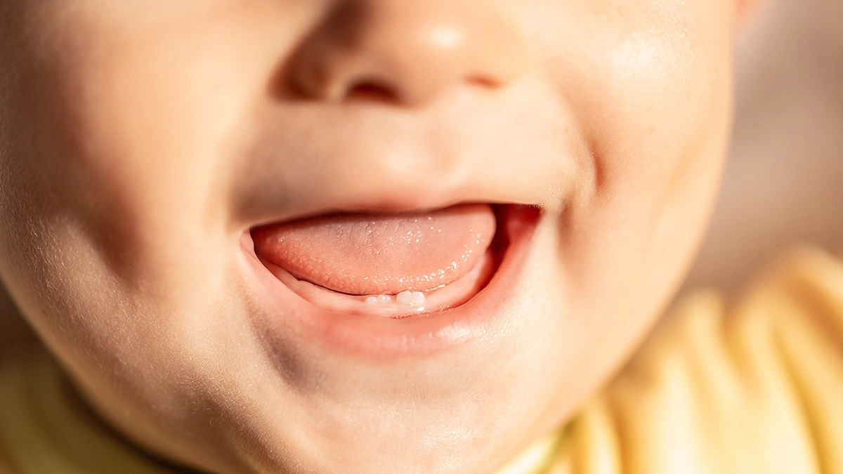 Why Baby Teeth Are Important for Jaw Alignment